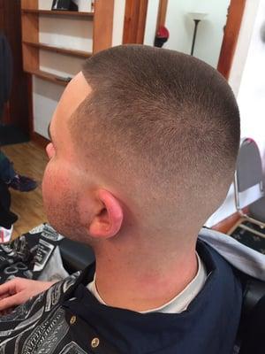 Skin fade