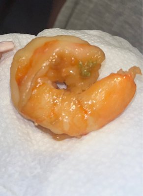 Shrimp with broccoli had a hair on it