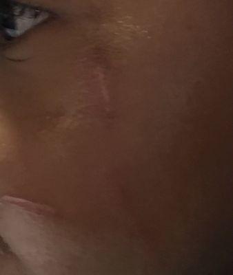 Pic of daughter's scratched face