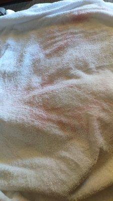 More stained towels