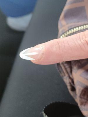 Near the cuticle of my mom's nails look bubbled like there's something underneath or they're lifting or something