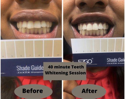 Results after one LED Teeth Whitening session! This client is 3 shades whiter