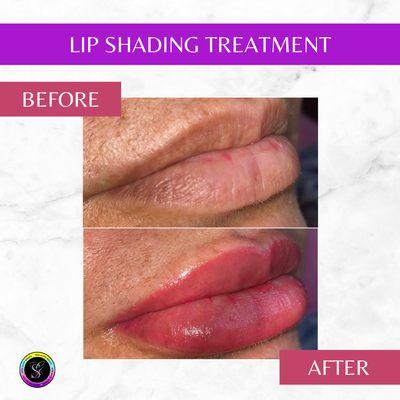 This is Lip Shading or Lightening Lip Shading treatment. The result defines and enhances your lips making them lighter and plumper with a lo