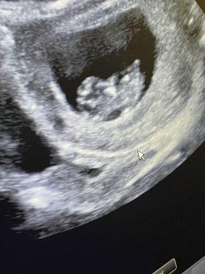 Baby's first photos. Mom got to hear my heartbeat today.