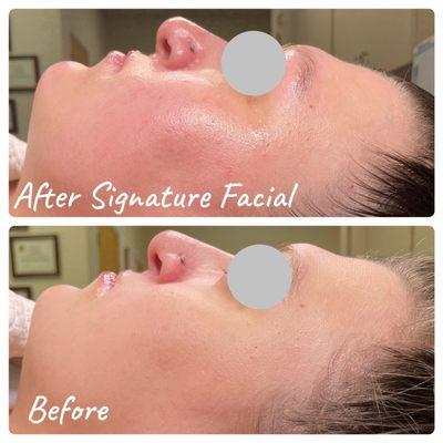 Elite Signature Facial