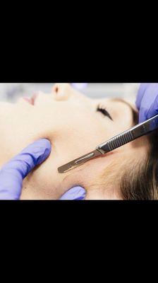 Dermaplaning Treatment, Great way to exfoliate and remove unwanted hair , leaving your your skin bright and smooth.