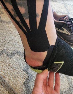 Athletic taping using RockTape.