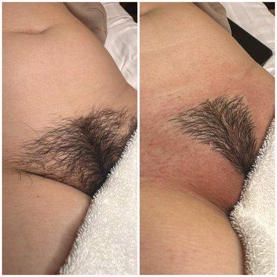 Brazilian sugar wax