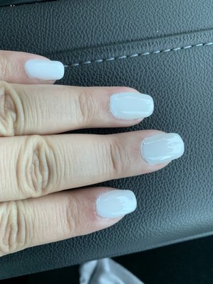 Ugly nails