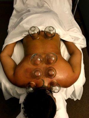 Cupping