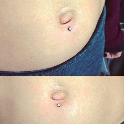 Dermal Piercing by Jenny Chambliss