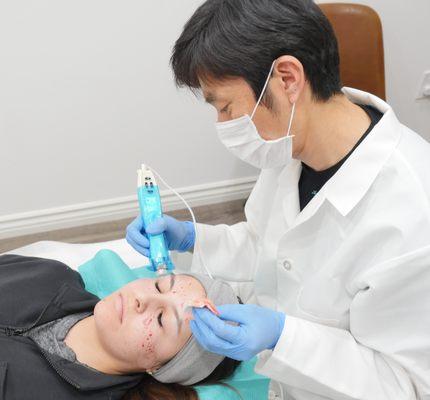 Dr.Ozawa performing the microneedling after injecting PRP into the skin.