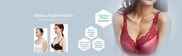 Breast Augmentation Diagrams