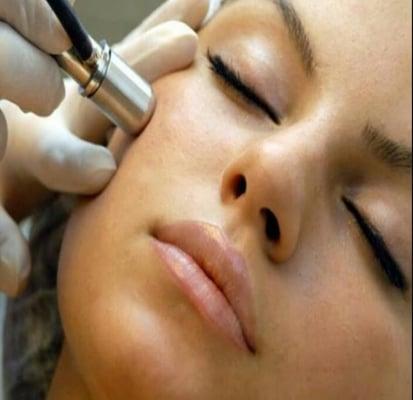 Best Microdermabrasion Treatments!