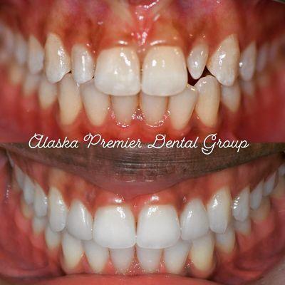 Alaska Premier Dental Group-Wasilla