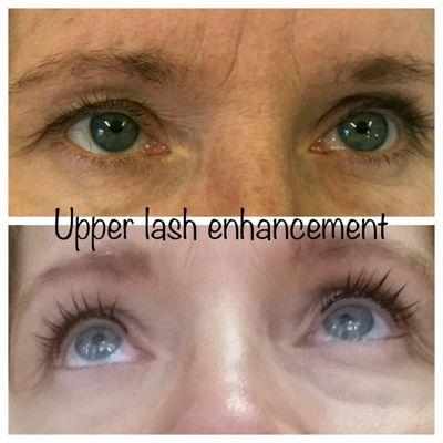 Upper lash enhancement