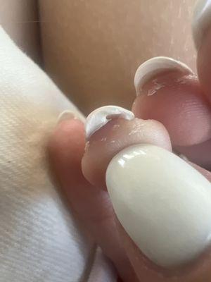 Acrylic under my nail