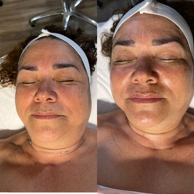 Radiant Facial