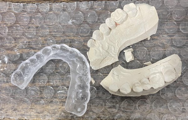 The Mouthguard costs me $300, even if this plastic thing is not adapted to my teeth! Same Bullshit thing sells on eBay $2. 24-$3,