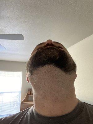 A horrible beard trim.