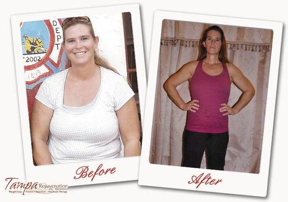 Tampa Rejuvenation Testimonial