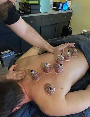 Cupping Services