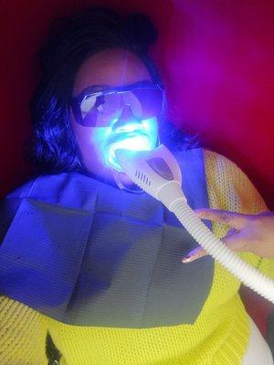 Getting my teef whitened!