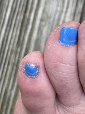 This is the pedicure I received today at Creative Nails in Norwell. Come here if you want your nails to look like this!