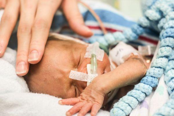 NICU photoshoot of an adorable micropremie!