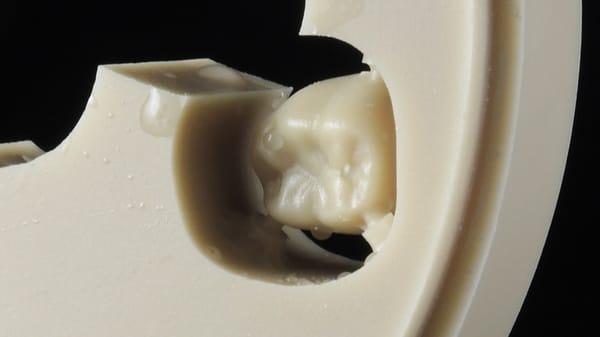 Milled wax crowns and bridges for casting in alloy or pressed ceramic from Udell Dental Laboratory.