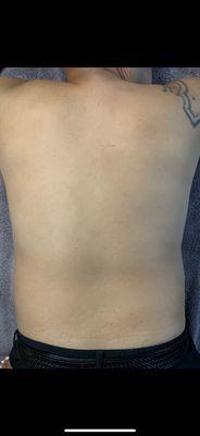 After photo of men's full back sugaring hair removal.
Lasts about 3-4 weeks