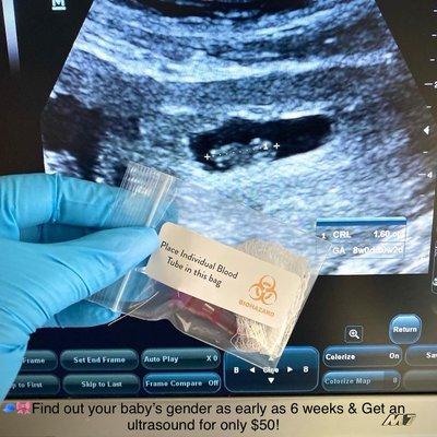 Find out your baby's gender as early as 6 weeks! Book a Sneak Peek Gender Test & get an ultrasound for $50!