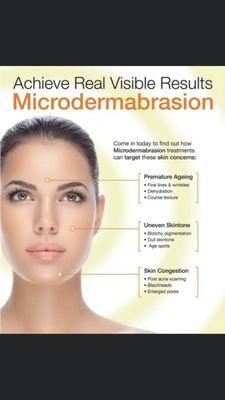 Microdermabrasion