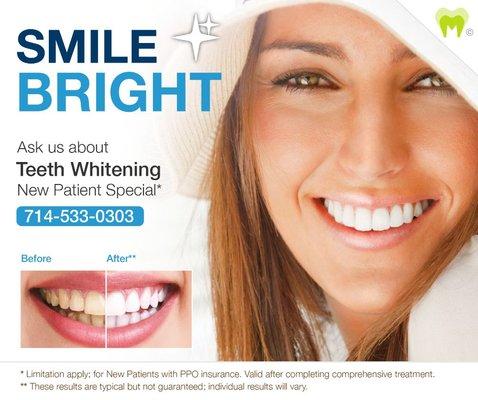 Brighten up your smile!