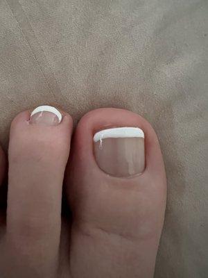 They clipped my toenails too short and ripped my cuticle! Very painful.