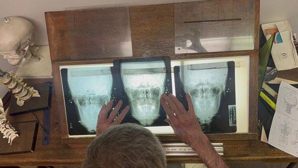 Xrays measurement process