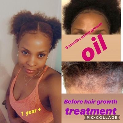 Hair growth oil, hair growth, healthy hair, hair treatment, hair steaming, deep conditioning, deep treatment