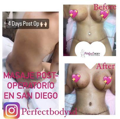 Perfectbodysd