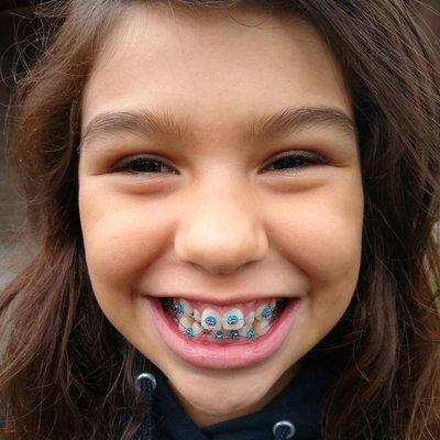 Mercedes in braces