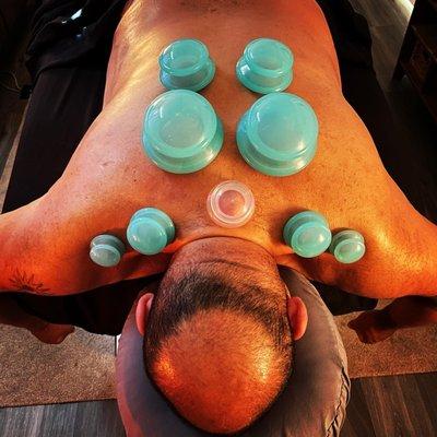 Cupping to enhance muscle release.