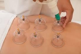 Cupping Therapy is great for releasing toxins and stagnant energy in your cells and tissue.