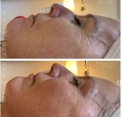 Just Skin Signature Facial