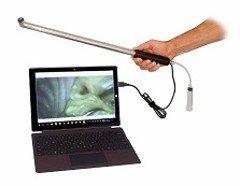 Our Equine Dental Camera has high resolution with super bright LED's and is able to save images to a computer, laptop, or tablet.