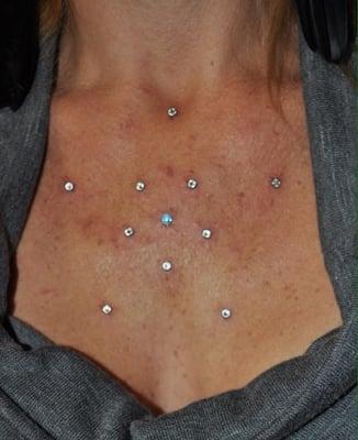 Microdermals Star shaped on chest