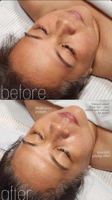 Revitalize Facial