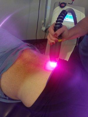 Infared laser treatment