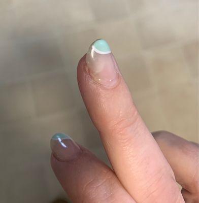 Acrylic lifting mid nail