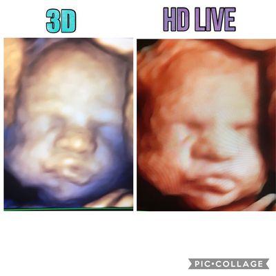 Sweet Pea 3D/4D Ultrasound