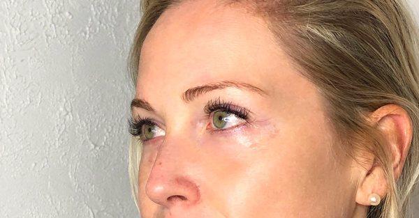 Eye Lash Extensions