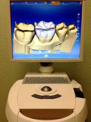 Cerec CAD/CAM single visit, same day crown technology at Dr. Vardanian's Roseville, CA dental office.